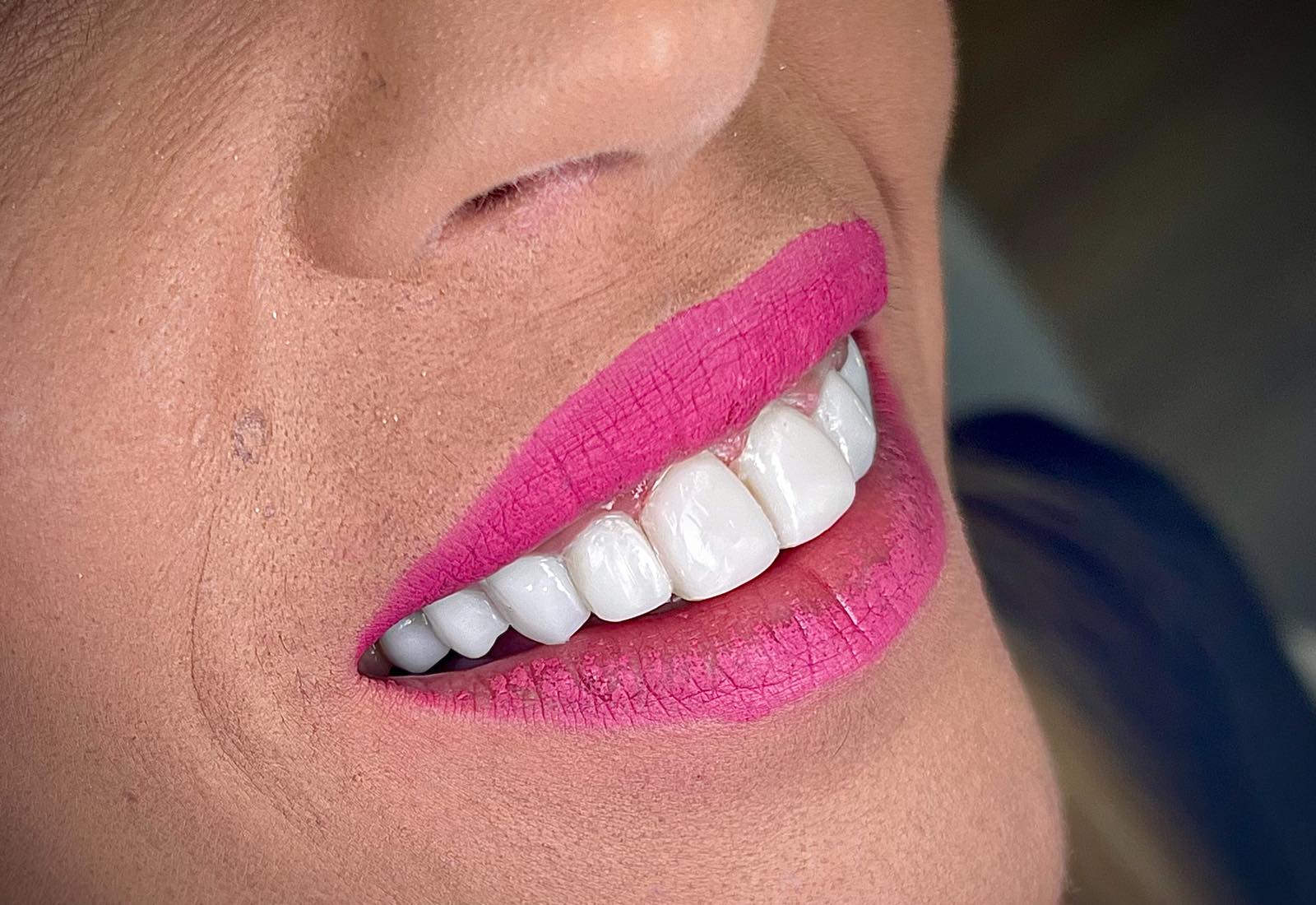 Όψεις Ρητίνης